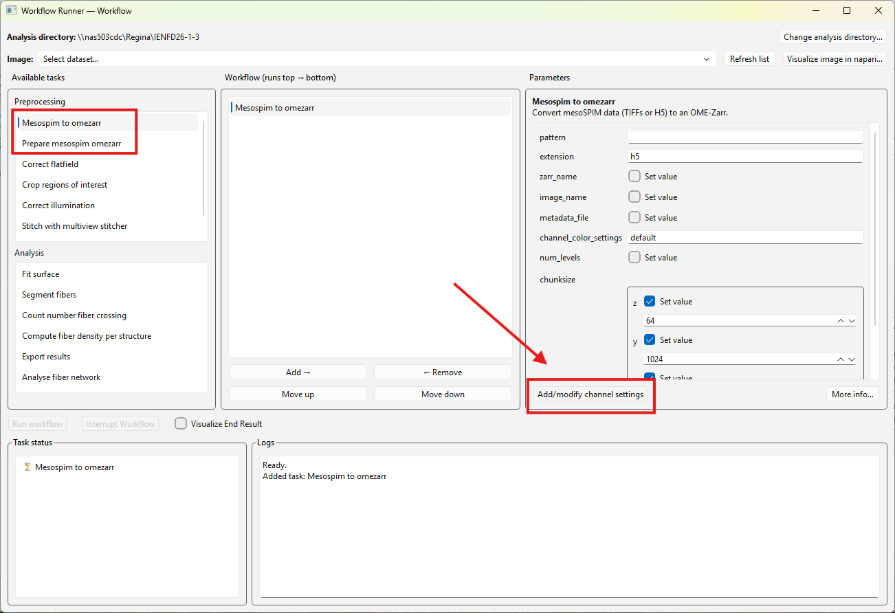 Channel settings button