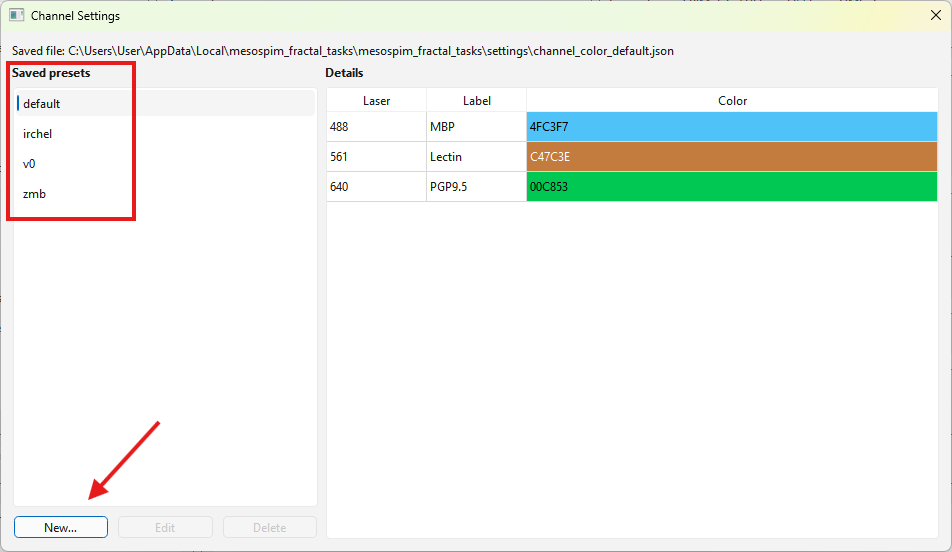 Channel settings window
